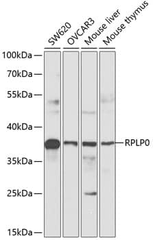 Western Blot: RPLP0 Antibody [NBP3-35373] - Western blot analysis of various lysates using RPLP0 Rabbit pAb at 1:1000 dilution.Secondary antibody: HRP-conjugated Goat anti-Rabbit IgG (H+L) at 1:10000 dilution.Lysates/proteins: 25ug per lane.Blocking buffer: 3% nonfat dry milk in TBST.Detection: ECL Basic Kit.Exposure time: 90s.