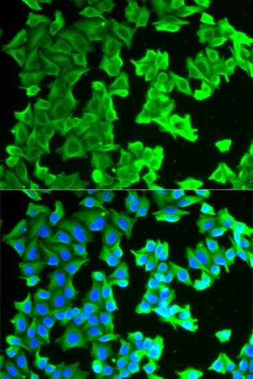 Immunocytochemistry/ Immunofluorescence: RPLP0 Antibody [NBP3-35373] - Immunofluorescence analysis of HeLa cells using RPLP0 Rabbit pAb. Secondary antibody: Cy3-conjugated Goat anti-Rabbit IgG (H+L) at 1:500 dilution. Blue: DAPI for nuclear staining.