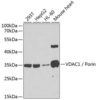 Western Blot: VDAC1 Antibody [NBP3-35374] - Western blot analysis of various lysates using VDAC1 Rabbit pAb at 1:1000 dilution.Secondary antibody: HRP-conjugated Goat anti-Rabbit IgG (H+L) at 1:10000 dilution.Lysates/proteins: 25ug per lane.Blocking buffer: 3% nonfat dry milk in TBST.