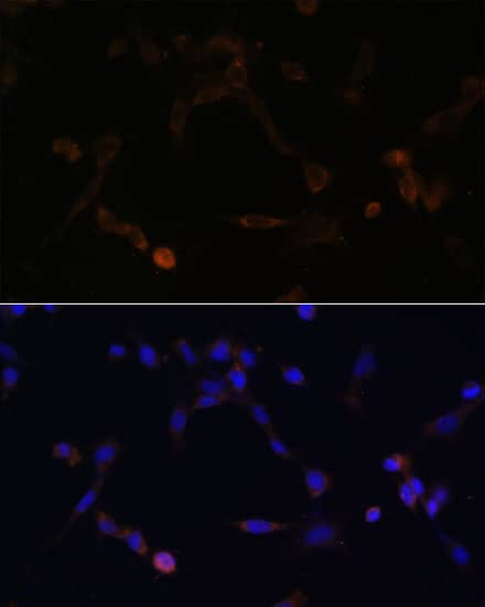 Immunocytochemistry/ Immunofluorescence: UbcH8/Ube2L6 Antibody [NBP3-35375] - Immunofluorescence analysis of NIH/3T3 cells using UbcH8/Ube2L6 Rabbit pAb at dilution of 1:100. Secondary antibody: Cy3-conjugated Goat anti-Rabbit IgG (H+L) at 1:500 dilution. Blue: DAPI for nuclear staining.