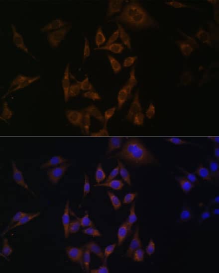 Immunocytochemistry/ Immunofluorescence: UbcH8/Ube2L6 Antibody [NBP3-35375] - Immunofluorescence analysis of HeLa cells using UbcH8/Ube2L6 Rabbit pAb at dilution of 1:100. Secondary antibody: Cy3-conjugated Goat anti-Rabbit IgG (H+L) at 1:500 dilution. Blue: DAPI for nuclear staining.