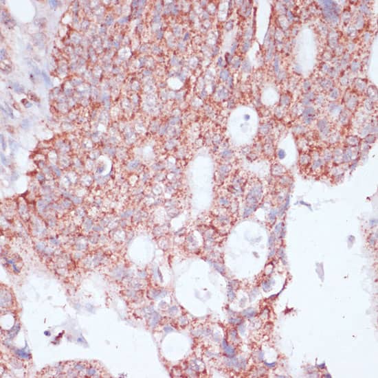 Immunohistochemistry RPL30 Antibody