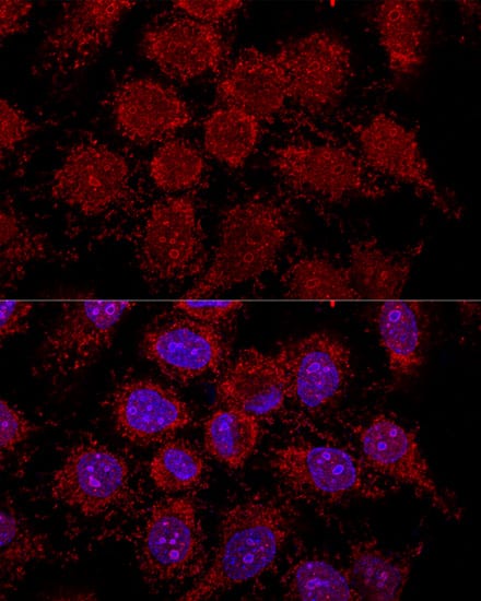 Immunocytochemistry/ Immunofluorescence RPL30 Antibody