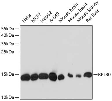 Western Blot: RPL30 Antibody [NBP3-35377] - Western blot analysis of various lysates using RPL30 Rabbit pAb at 1:3000 dilution.Secondary antibody: HRP-conjugated Goat anti-Rabbit IgG (H+L) at 1:10000 dilution.Lysates/proteins: 25ug per lane.Blocking buffer: 3% nonfat dry milk in TBST.Detection: ECL Basic Kit.Exposure time: 10s.