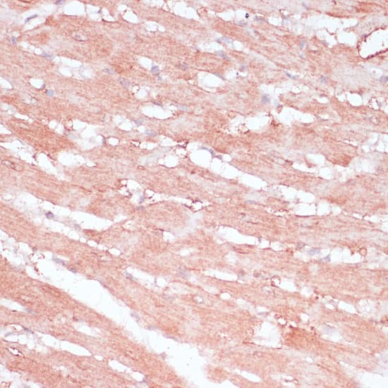 Immunohistochemistry RPL30 Antibody