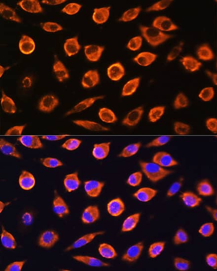 Immunocytochemistry/ Immunofluorescence RND1 Antibody - BSA Free