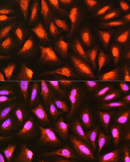 Immunocytochemistry/ Immunofluorescence: MDFI Antibody [NBP3-35380] - Immunofluorescence analysis of U-2 OS cells using MDFI Rabbit pAb at dilution of 1:100 (40x lens). Secondary antibody: Cy3-conjugated Goat anti-Rabbit IgG (H+L) at 1:500 dilution. Blue: DAPI for nuclear staining.