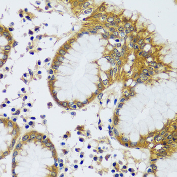 Immunohistochemistry: CAMLG Antibody [NBP3-35381] - Immunohistochemistry analysis of paraffin-embedded Human stomach using CAMLG Rabbit pAb at dilution of 1:100 (40x lens). Microwave antigen retrieval performed with 0.01M PBS Buffer (pH 7.2) prior to IHC staining.