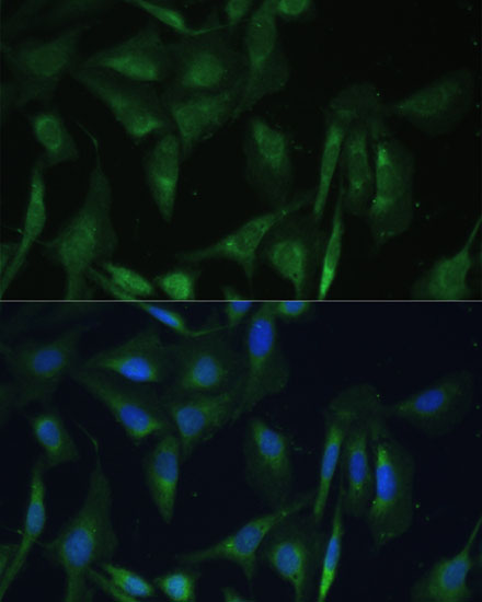 Immunocytochemistry/ Immunofluorescence: CAMLG Antibody [NBP3-35381] - Immunofluorescence analysis of U-2 OS cells using CAMLG Rabbit pAb at dilution of 1:100 (40x lens). Secondary antibody: Cy3-conjugated Goat anti-Rabbit IgG (H+L) at 1:500 dilution. Blue: DAPI for nuclear staining.