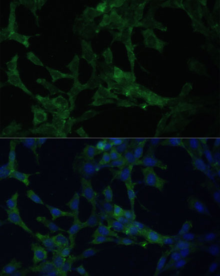 Immunocytochemistry/ Immunofluorescence: CAMLG Antibody [NBP3-35381] - Immunofluorescence analysis of NIH-3T3 cells using CAMLG Rabbit pAb at dilution of 1:100 (40x lens). Secondary antibody: Cy3-conjugated Goat anti-Rabbit IgG (H+L) at 1:500 dilution. Blue: DAPI for nuclear staining.