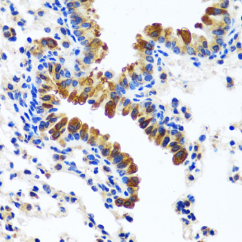 Immunohistochemistry: CAMLG Antibody [NBP3-35381] - Immunohistochemistry analysis of paraffin-embedded Mouse lung using CAMLG Rabbit pAb at dilution of 1:100 (40x lens). Microwave antigen retrieval performed with 0.01M PBS Buffer (pH 7.2) prior to IHC staining.