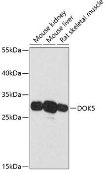 Western Blot: DOK5 Antibody [NBP3-35382] - Western blot analysis of various lysates using DOK5 Rabbit pAb at 1:3000 dilution.Secondary antibody: HRP-conjugated Goat anti-Rabbit IgG (H+L) at 1:10000 dilution.Lysates/proteins: 25ug per lane.Blocking buffer: 3% nonfat dry milk in TBST.Detection: ECL Basic Kit.Exposure time: 30s.