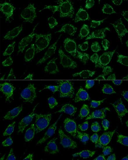 Immunocytochemistry/ Immunofluorescence: IDH3B Antibody [NBP3-35384] - Immunofluorescence analysis of L929 cells using IDH3B Rabbit pAb at dilution of 1:100 (40x lens). Secondary antibody: Cy3-conjugated Goat anti-Rabbit IgG (H+L) at 1:500 dilution. Blue: DAPI for nuclear staining.