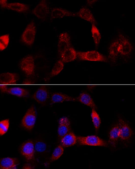 Immunocytochemistry/ Immunofluorescence: CYP1B1 Antibody [NBP3-35386] - Immunofluorescence analysis of NIH/3T3 cells using CYP1B1 Rabbit pAb at dilution of 1:100 (40x lens). Secondary antibody: Cy3-conjugated Goat anti-Rabbit IgG (H+L) at 1:500 dilution. Blue: DAPI for nuclear staining.