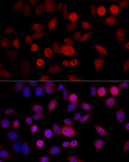 Immunocytochemistry/ Immunofluorescence: CYP1B1 Antibody [NBP3-35386] - Immunofluorescence analysis of HeLa cells using CYP1B1 Rabbit pAb at dilution of 1:100 (40x lens). Secondary antibody: Cy3-conjugated Goat anti-Rabbit IgG (H+L) at 1:500 dilution. Blue: DAPI for nuclear staining.