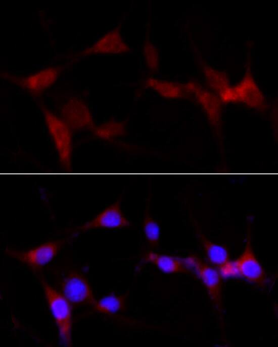 Immunocytochemistry/ Immunofluorescence: CYP1B1 Antibody [NBP3-35386] - Immunofluorescence analysis of PC-12 cells using CYP1B1 Rabbit pAb at dilution of 1:100 (40x lens). Secondary antibody: Cy3-conjugated Goat anti-Rabbit IgG (H+L) at 1:500 dilution. Blue: DAPI for nuclear staining.