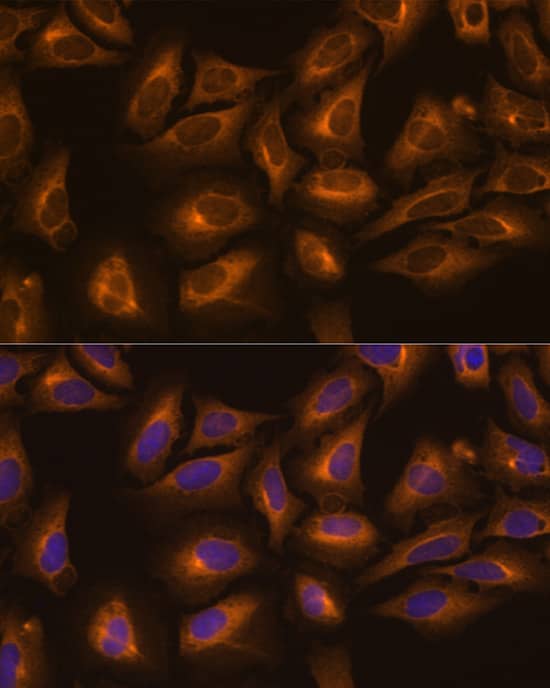 Immunocytochemistry/ Immunofluorescence: Lysyl tRNA synthetase Antibody [NBP3-35387] - Immunofluorescence analysis of U-2 OS cells using Lysyl tRNA synthetase Rabbit pAb at dilution of 1:100 (40x lens). Secondary antibody: Cy3-conjugated Goat anti-Rabbit IgG (H+L) at 1:500 dilution. Blue: DAPI for nuclear staining.