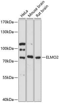 Western Blot: ELMO2 Antibody [NBP3-35389] - Western blot analysis of various lysates using ELMO2 Rabbit pAb at 1:3000 dilution.Secondary antibody: HRP-conjugated Goat anti-Rabbit IgG (H+L) at 1:10000 dilution.Lysates/proteins: 25ug per lane.Blocking buffer: 3% nonfat dry milk in TBST.Detection: ECL Basic Kit.Exposure time: 90s.