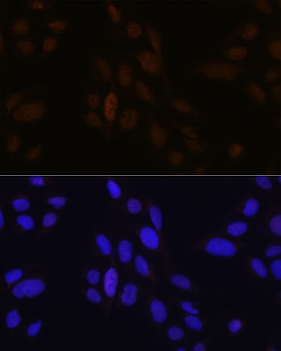 Immunocytochemistry/ Immunofluorescence: Pea3 Antibody [NBP3-35390] - Immunofluorescence analysis of U-2 OS cells using Pea3 Rabbit pAb at dilution of 1:100 (40x lens). Secondary antibody: Cy3 Goat Anti-Rabbit IgG (H+L) at 1:500 dilution. Blue: DAPI for nuclear staining.