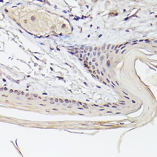 Immunohistochemistry Pea3 Antibody