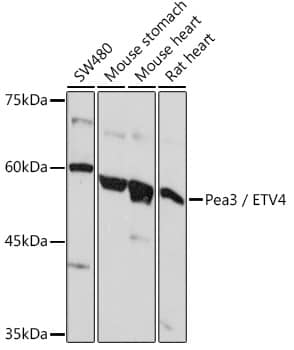 Western Blot: Pea3 Antibody [NBP3-35390] - Western blot analysis of various lysates using Pea3 Rabbit pAb at 1:1000 dilution.Secondary antibody: HRP-conjugated Goat anti-Rabbit IgG (H+L) at 1:10000 dilution.Lysates/proteins: 25ug per lane.Blocking buffer: 3% nonfat dry milk in TBST.Detection: ECL Basic Kit.Exposure time: 5s.