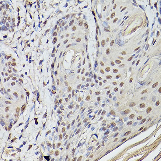 Immunohistochemistry: Pea3 Antibody [NBP3-35390] - Immunohistochemistry analysis of paraffin-embedded Human skin using Pea3 Rabbit pAb at dilution of 1:100 (40x lens). High pressure antigen retrieval performed with 0.01M Citrate Bufferr (pH 6.0) prior to IHC staining.