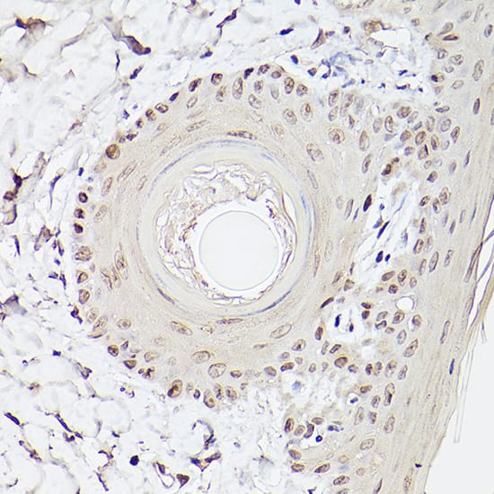 Immunohistochemistry: Pea3 Antibody [NBP3-35390] - Immunohistochemistry analysis of paraffin-embedded Rat skin using Pea3 Rabbit pAb at dilution of 1:100 (40x lens). High pressure antigen retrieval performed with 0.01M Citrate Bufferr (pH 6.0) prior to IHC staining.