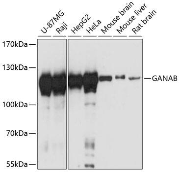 Western Blot: alpha Glucosidase 2 Antibody [NBP3-35393] - Western blot analysis of various lysates using alpha Glucosidase 2 Rabbit pAb at 1:3000 dilution.Secondary antibody: HRP-conjugated Goat anti-Rabbit IgG (H+L) at 1:10000 dilution.Lysates/proteins: 25ug per lane.Blocking buffer: 3% nonfat dry milk in TBST.Detection: ECL Basic Kit.Exposure time: 10s.