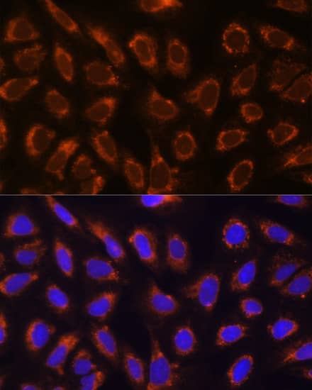 Immunocytochemistry/ Immunofluorescence: alpha Glucosidase 2 Antibody [NBP3-35393] - Immunofluorescence analysis of U-2 OS cells using alpha Glucosidase 2 Rabbit pAb at dilution of 1:100. Secondary antibody: Cy3-conjugated Goat anti-Rabbit IgG (H+L) at 1:500 dilution. Blue: DAPI for nuclear staining.