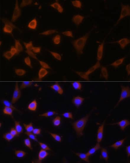 Immunocytochemistry/ Immunofluorescence: alpha Glucosidase 2 Antibody [NBP3-35393] - Immunofluorescence analysis of NIH-3T3 cells using alpha Glucosidase 2 Rabbit pAb at dilution of 1:100. Secondary antibody: Cy3-conjugated Goat anti-Rabbit IgG (H+L) at 1:500 dilution. Blue: DAPI for nuclear staining.