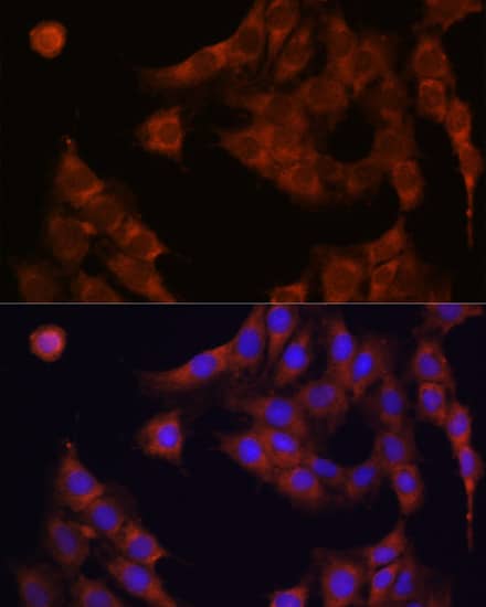 Immunocytochemistry/ Immunofluorescence: alpha Glucosidase 2 Antibody [NBP3-35393] - Immunofluorescence analysis of C6 cells using alpha Glucosidase 2 Rabbit pAb at dilution of 1:100. Secondary antibody: Cy3-conjugated Goat anti-Rabbit IgG (H+L) at 1:500 dilution. Blue: DAPI for nuclear staining.