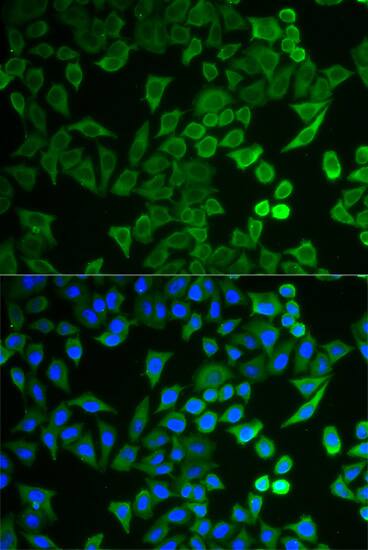 Immunocytochemistry/ Immunofluorescence TUSC4 Antibody - BSA Free