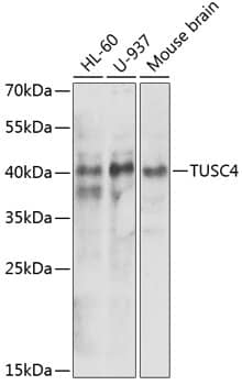 Western Blot TUSC4 Antibody - BSA Free