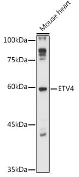 Western Blot: Pea3 Antibody [NBP3-35396] - Western blot analysis of lysates from Mouse heart, using Pea3 Rabbit pAb at 1:1000 dilution.Secondary antibody: HRP-conjugated Goat anti-Rabbit IgG (H+L) at 1:10000 dilution.Lysates/proteins: 25ug per lane.Blocking buffer: 3% nonfat dry milk in TBST.Detection: ECL Basic Kit.Exposure time: 30s.