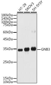 Western Blot: GNB3 Antibody [NBP3-35397] - Western blot analysis of various lysates using GNB3 Rabbit pAb at 1:1000 dilution.Secondary antibody: HRP-conjugated Goat anti-Rabbit IgG (H+L) at 1:10000 dilution.Lysates/proteins: 25ug per lane.Blocking buffer: 3% nonfat dry milk in TBST.Detection: ECL Basic Kit.Exposure time: 180s.