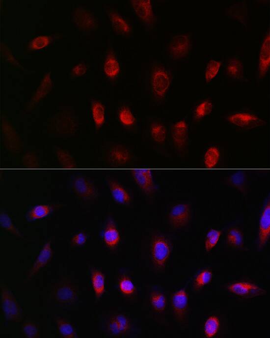 Immunocytochemistry/ Immunofluorescence: GNB3 Antibody [NBP3-35397] - Immunofluorescence analysis of U-251MG cells using GNB3 Rabbit pAb at dilution of 1:50 (40x lens). Secondary antibody: Cy3-conjugated Goat anti-Rabbit IgG (H+L) at 1:500 dilution. Blue: DAPI for nuclear staining.