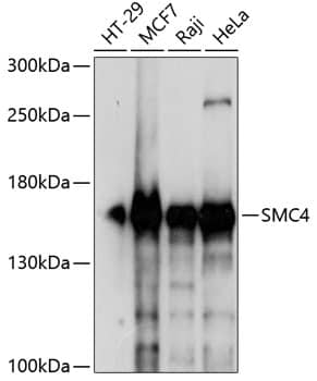 Western Blot: SMC4 Antibody [NBP3-35400] - Western blot analysis of various lysates using SMC4 Rabbit pAb at 1:1000 dilution.Secondary antibody: HRP-conjugated Goat anti-Rabbit IgG (H+L) at 1:10000 dilution.Lysates/proteins: 25ug per lane.Blocking buffer: 3% nonfat dry milk in TBST.Detection: ECL Enhanced Kit.Exposure time: 3s.