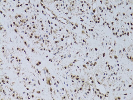 Immunohistochemistry HUS1 Antibody - BSA Free