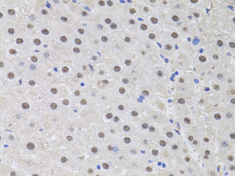 Immunohistochemistry HUS1 Antibody - BSA Free