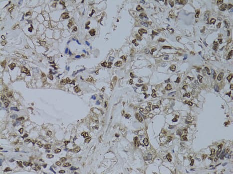 Immunohistochemistry HUS1 Antibody - BSA Free