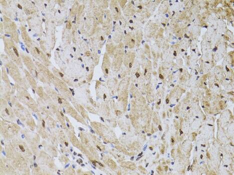 Immunohistochemistry HUS1 Antibody - BSA Free