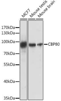 Western Blot: NCBP1 Antibody [NBP3-35402] - Western blot analysis of various lysates using NCBP1 Rabbit pAb at 1:1000 dilution.Secondary antibody: HRP-conjugated Goat anti-Rabbit IgG (H+L) at 1:10000 dilution.Lysates/proteins: 25ug per lane.Blocking buffer: 3% nonfat dry milk in TBST.Detection: ECL Basic Kit.Exposure time: 5s.