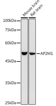 Western Blot: AP2M1 Antibody [NBP3-35403] - Western blot analysis of various lysates using AP2M1 Rabbit pAb at 1:500 dilution.Secondary antibody: HRP-conjugated Goat anti-Rabbit IgG (H+L) at 1:10000 dilution.Lysates/proteins: 25ug per lane.Blocking buffer: 3% nonfat dry milk in TBST.Detection: ECL Basic Kit.Exposure time: 10s.