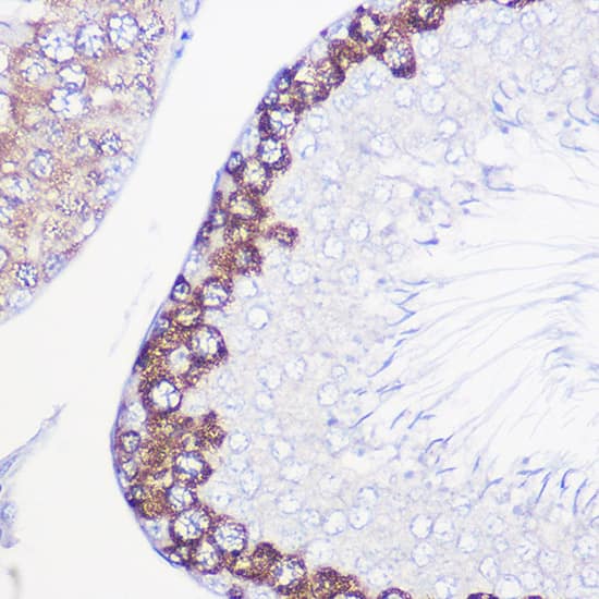 Immunohistochemistry: DAZL Antibody [NBP3-35406] - Immunohistochemistry analysis of paraffin-embedded Rat testis using DAZL Rabbit pAb at dilution of 1:100 (40x lens). High pressure antigen retrieval performed with 0.01M Citrate Bufferr (pH 6.0) prior to IHC staining.