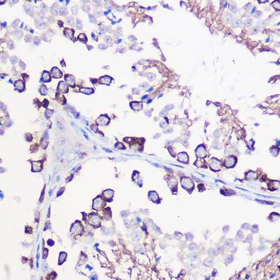 Immunohistochemistry: DAZL Antibody [NBP3-35406] - Immunohistochemistry analysis of paraffin-embedded Mouse testis using DAZL Rabbit pAb at dilution of 1:100 (40x lens). High pressure antigen retrieval performed with 0.01M Citrate Bufferr (pH 6.0) prior to IHC staining.