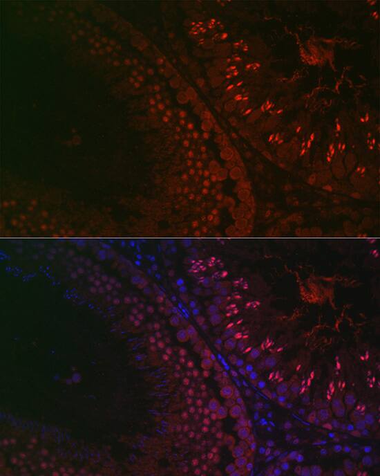 Immunocytochemistry/ Immunofluorescence: DAZL Antibody [NBP3-35406] - Immunofluorescence analysis of paraffin-embedded rat testis using DAZL Rabbit pAb at dilution of 1:100 (40x lens). Secondary antibody: Cy3-conjugated Goat anti-Rabbit IgG (H+L) at 1:500 dilution. Blue: DAPI for nuclear staining.