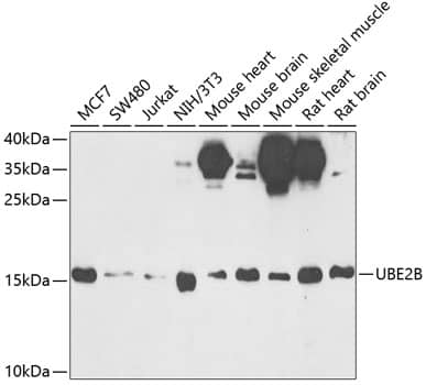 Western Blot: HR6B/UBE2B Antibody [NBP3-35407] - Western blot analysis of various lysates using HR6B/UBE2B Rabbit pAb at 1:1000 dilution.Secondary antibody: HRP-conjugated Goat anti-Rabbit IgG (H+L) at 1:10000 dilution.Lysates/proteins: 25ug per lane.Blocking buffer: 3% nonfat dry milk in TBST.Detection: ECL Enhanced Kit.Exposure time: 90s.