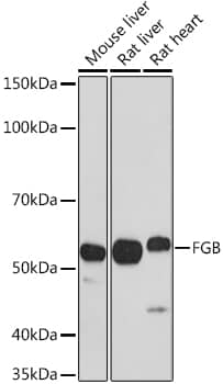 Western Blot: Fibrinopeptide B Antibody [NBP3-35409] - Western blot analysis of various lysates using Fibrinopeptide B Rabbit pAb at 1:1000 dilution.Secondary antibody: HRP-conjugated Goat anti-Rabbit IgG (H+L) at 1:10000 dilution.Lysates/proteins: 25ug per lane.Blocking buffer: 3% nonfat dry milk in TBST.Detection: ECL Basic Kit.Exposure time: 10s.