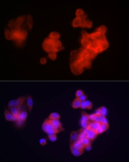 Immunocytochemistry/ Immunofluorescence: Fibrinopeptide B Antibody [NBP3-35409] - Immunofluorescence analysis of HepG2 cells using Fibrinopeptide B Rabbit pAb at dilution of 1:100 (40x lens). Secondary antibody: Cy3-conjugated Goat anti-Rabbit IgG (H+L) at 1:500 dilution. Blue: DAPI for nuclear staining.