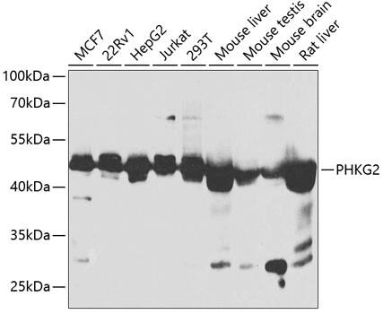 Western Blot: PHKG2 Antibody [NBP3-35410] - Western blot analysis of various lysates using PHKG2 Rabbit pAb at 1:1000 dilution.Secondary antibody: HRP-conjugated Goat anti-Rabbit IgG (H+L) at 1:10000 dilution.Lysates/proteins: 25ug per lane.Blocking buffer: 3% nonfat dry milk in TBST.Detection: ECL Enhanced Kit.Exposure time: 30s.